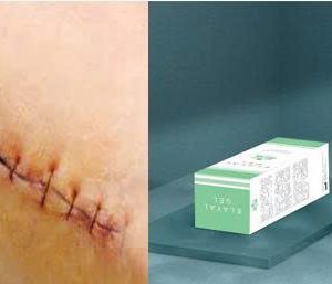 Gel trị Sẹo Elayal Italy